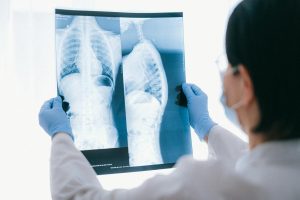 Medical professional analyzing chest x-ray images in a clinical setting for diagnostic purposes
