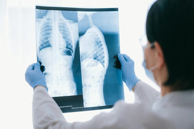 Medical professional analyzing chest x-ray images in a clinical setting for diagnostic purposes
